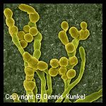 Cladosporium spp. Cladosporium spp.