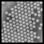 Poliovirus (Enterovirus C)