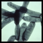 Legionella pneumophila Legionella pneumophila