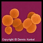 Neisseria meningitidis Neisseria meningitidis