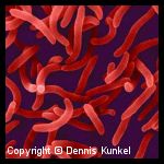 Vibrio cholerae Vibrio cholerae